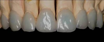 dientes