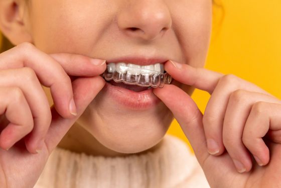 Dientes de leche: importancia y cuidados esenciales